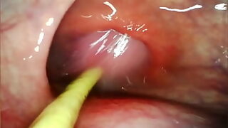 18 first hardcore anal