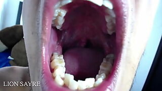 ass hole wide open eww so much poop insse