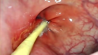17 yr old orgasm