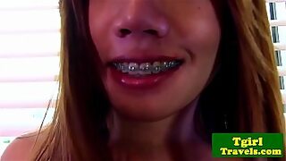 18 blonde braces