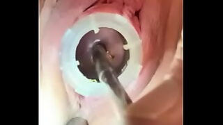 anal bubble butt