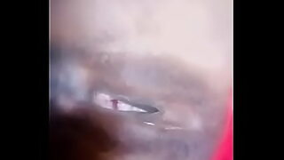 anl dart