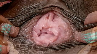 18year girls vagina