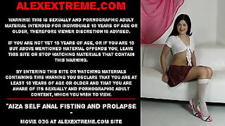 ass prolapse