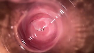 bursting bladder