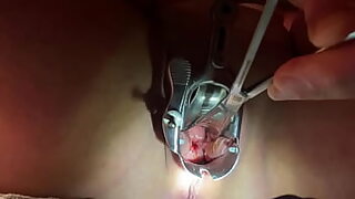 catheter insertion