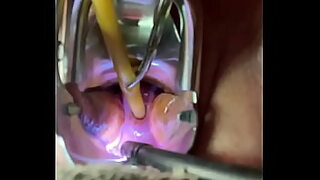 anal insertion fist