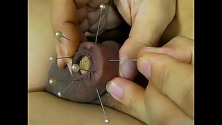 foreskin