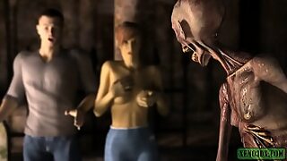 anorexic skinny