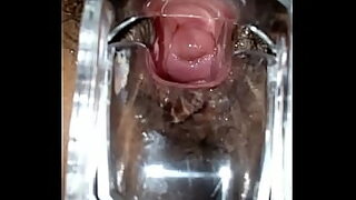 2 vaginal