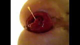 aiza prolapse