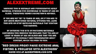 ass prolapse