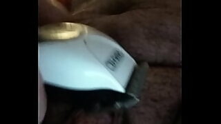 arm amputee