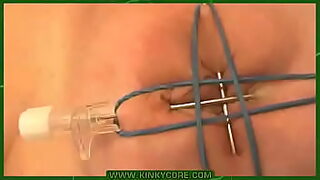 dr insertion shounde urethral