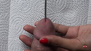 anal insertion fist