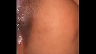 anal fail accident